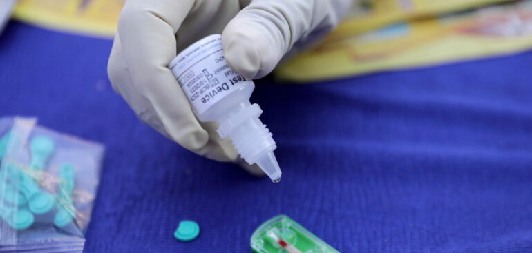 hiv,-ok-ue-a-farmaco-profilassi-iniettabile-due-volte-all’anno