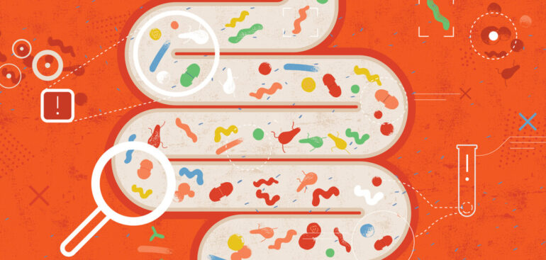 allergie,-la-chiave-e-nel-microbiota-intestinale