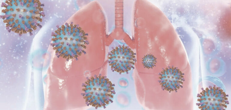 virus-sinciziale,-bene-copertura-neonati-ma-anziani-a-rischio