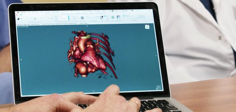 amiloidosi-cardiaca,-nasce-il-primo-registro-nazionale