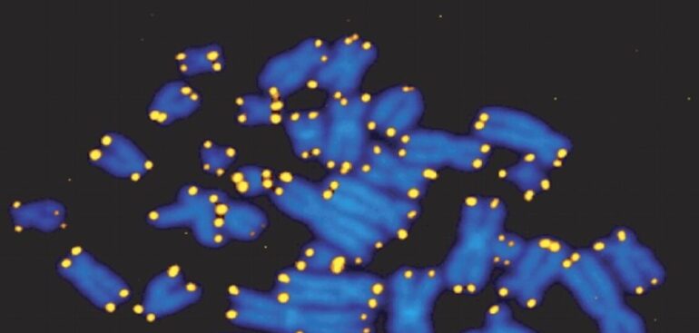 l’invecchiamento-del-dna-alla-base-dell’alzheimer,-lo-studio-italiano