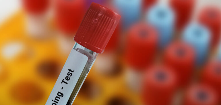 doping:-pregliasco,-il-letrozolo-nella-liste-nera-degli-atleti