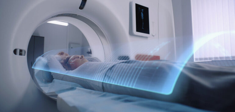 strumento-di-ia-puo-‘leggere’-l’eta-del-cervello-ed-il-rischio-alzheimer