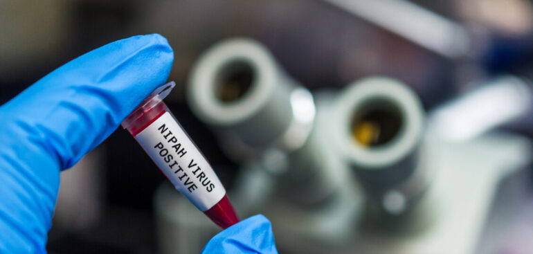 ad-aprile-i-primi-test-per-un-vaccino-contro-il-virus-nipah