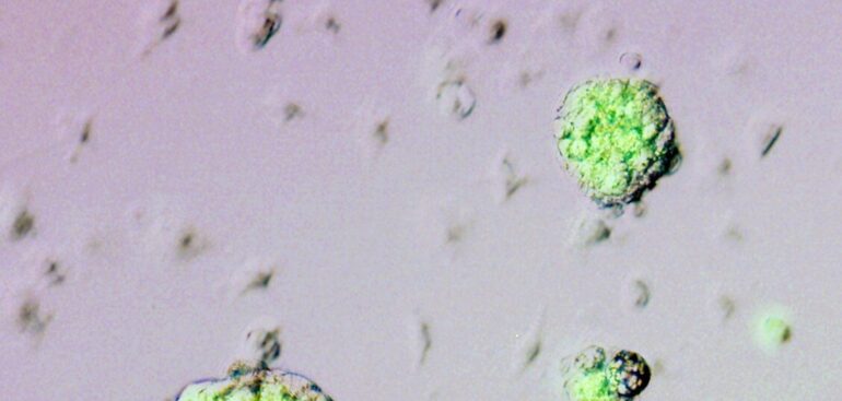 un-nuovo-trattamento-sottocute-mensile-per-una-forma-di-anemia-emolitica