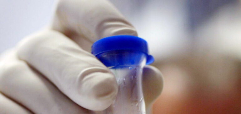 in-campania-acque-sotterranee-contaminate-da-agenti-cancerogeni