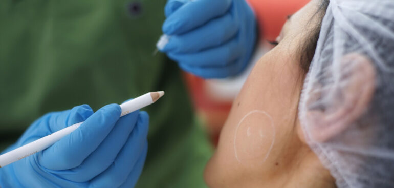 ‘tweakments’-e-medicina-rigenerativa,-i-trend-dell’estetica-nel-2026