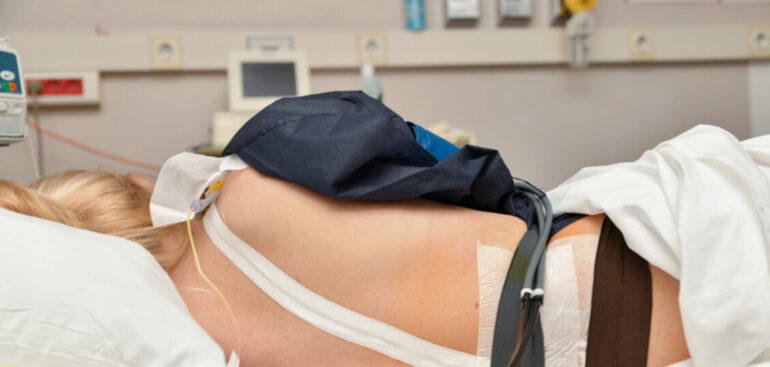 l’epidurale-in-travaglio-non-aumenta-il-rischio-di-parto-cesareo