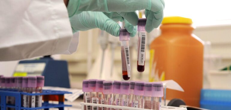 donna-mori-per-sangue-infetto,-ministero-salute-condannato-48-anni-dopo