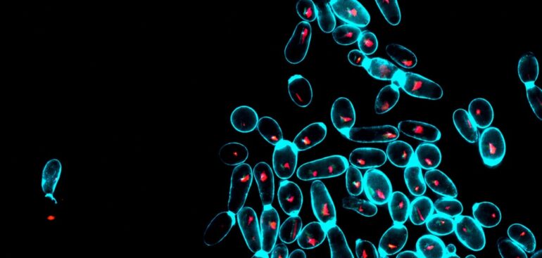 i-lieviti-nel-kefir-riportano-equilibrio-nel-microbiota-intestinale