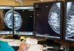 tumore-al-seno,-con-la-diagnosi-precoce-la-sopravvivenza-a-10-anni-supera-il-90%