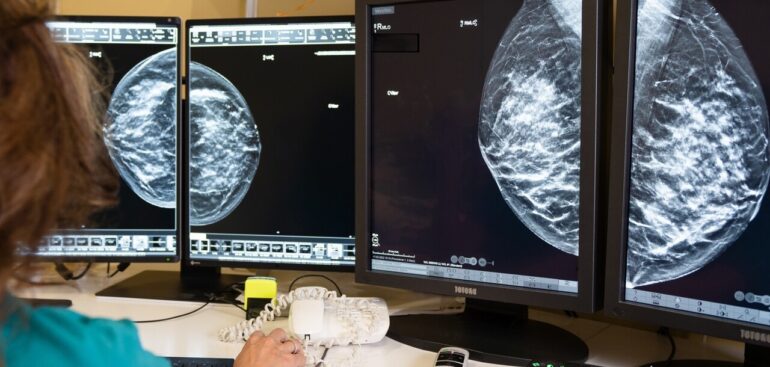 tumore-al-seno,-con-la-diagnosi-precoce-la-sopravvivenza-a-10-anni-supera-il-90%