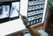 tumore-al-polmone,-l’ia-aiuta-a-predire-la-risposta-all’immunoterapia