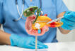 tumore-del-pancreas,-sviluppato-un-esame-del-sangue-per-la-diagnosi-precoce