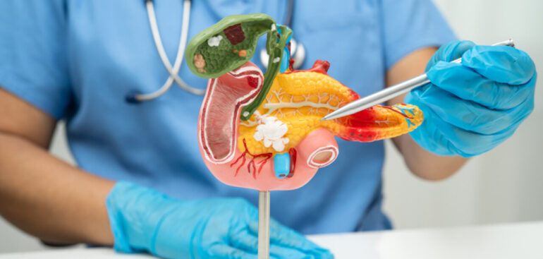 tumore-del-pancreas,-sviluppato-un-esame-del-sangue-per-la-diagnosi-precoce