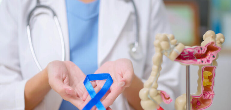 tumore-colon,-dopo-la-chirurgia-prelievi-di-sangue-aiuteranno-a-capire-rischio-recidive