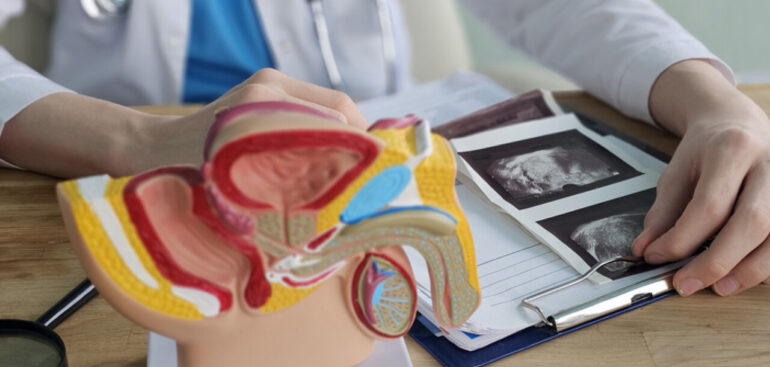 in-italia-485mila-uomini-con-tumore-alla-prostata.-una-‘carta-delle-domande’-per-orientarsi