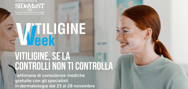 non-solo-macchie-chiare,-la-vitiligine-e-una-malattia-cronica-che-colpisce-300mila-persone