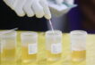 fentanyl,-possibili-falsi-positivi-nei-test-rapidi-in-presenza-di-un-farmaco
