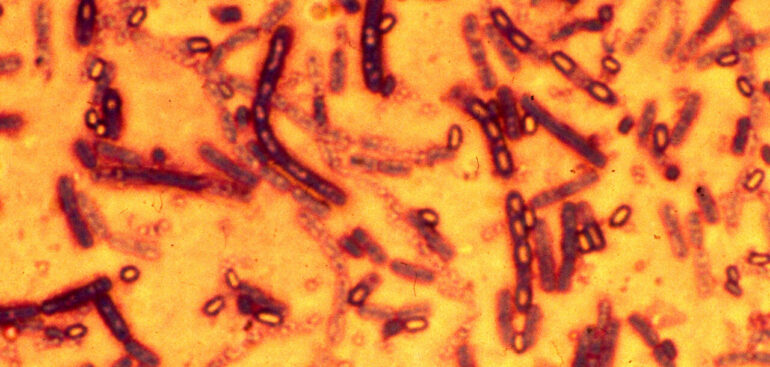 gemmato,-‘impegno-del-governo-su-antibiotico-resistenza’